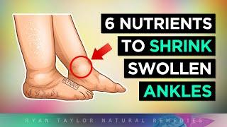 6 Nutrients To Shrink Swollen Ankles & Legs