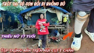 Thiếu nữ 17 tuổi CỤT 1 chân, TRÓT dại TRAO thân có con rồi bị RUỒNG BỎ../387