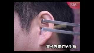 High-tech ear picking & ear cleaning TOP Secret Weapon - "Metal Gear"