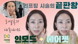 리프팅의 끝판왕 인모드에어젯, 실리프팅🪡 리프테라, 더블로골드 비교분석. 내돈내산⭕️️ 시술후기‼️‼️