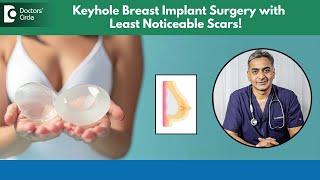 Keyhole Breast Augmentation: Small Scars, Big Results|Breast Implant-Dr.Srikanth V | Doctors' Circle