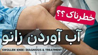 آب آوردن زانو - درمان آب آوردن زانو| How to treat knee Swelling & knee effusion