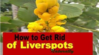 No More Liverspots with This Plant: Medicinal Plant Series - #3