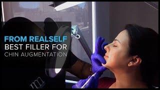 From RealSelf: "Best Filler for Chin Augmentation?"