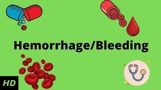 Hemorrhage /bleeding, Causes, Signs and Symptoms, Diagnosis and Treatment.