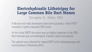 Electrohydraulic Lithotripsy for Large Common Bile Duct Stones by Dr. Adler