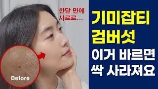 집에서 기미, 검버섯 없애는 방법! 이렇게 간단한데 피부과 왜 가요?