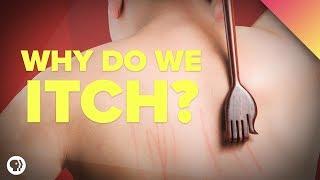 Why Do We Itch?