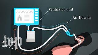 How ventilators work and why we need them to fight covid-19