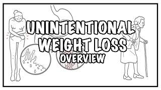 Approach to Unintentional Weight Loss - definition, differential diagnosis and treatment