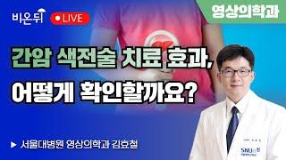 간암 색전술 치료 효과, 어떻게 확인할까요? / 서울대병원 영상의학과 김효철