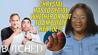 Chrystal's Toe Deformity Is Causing EXCRUCIATING PAIN (Before & After) | Botched | E!