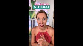 7 Tips To Help Relief VITILIGO #shorts