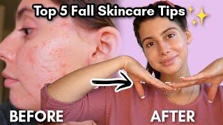 Top 5 Fall Skincare Tips that will transform your skin! 