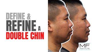 An Unexpected Way To Eliminate Double Chin | Mabrie Facial Institute in San Francisco, CA