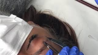 reakcija - microblading