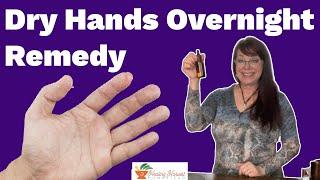 Dry Hands Overnight Remedy