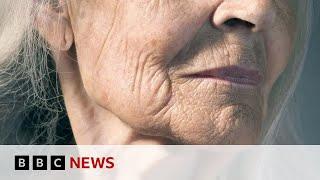 New skin research could help slow signs of ageing | BBC News