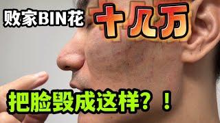 #尔湾生活白皮书  BINBIN在比弗利一次做脸话十几万？到底好不好！！