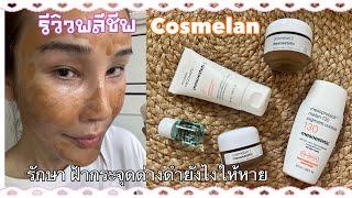 รีวิวนี้ พลีชีพ cosmelan ครีมรักษาฝ้ากระจุดด่างดำ