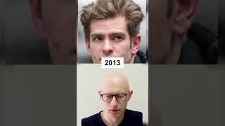 Did Andrew Garfield get a Hair Transplant?