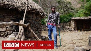 'I lost my leg on my way home from school'  - BBC Africa