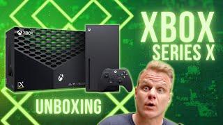 How To Get The XBox Series X Unboxing