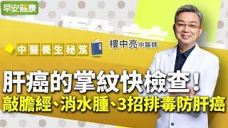 肝癌的掌紋快檢查！中醫博士教你敲膽經、消水腫、3招排毒防肝癌︱ 樓中亮 中醫師 【早安健康】