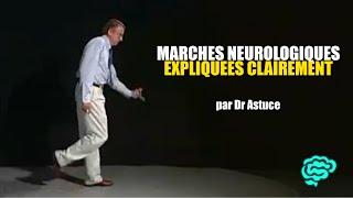  Marches neurologiques Expliquées Très Clairement par Dr Astuce