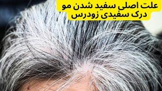 علت اصلی سفید شدن مو | درک سفیدی زودرس