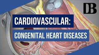 Cardiovascular: Congenital Heart Diseases | Doors to the Boards - Basic Sciences