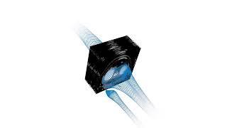 Dr. Richard L. Baumann | Stryker Mako Robot-Assisted Total Knee