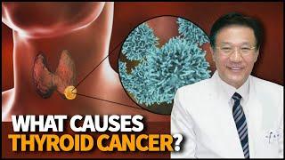 What are the main causes of Thyroid Cancer? Are there any symptoms and treatments?