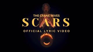 Scars (Official Lyric Video)