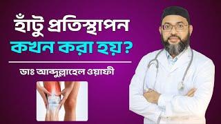 হাঁটু প্রতিস্থাপন কখন করা হয়? | Dr. Abdullahel Wafee | General and Orthopedic Surgeons