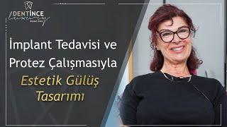 İmplant Tedavisi ve Protez Çalışmasıyla Estetik Gülüş Tasarımı