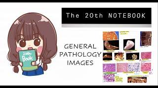 The 20th Notebook || MOST VOLATILE TOPICS || HIGH YIELD NEET PG 2022 || Part 1: Pathology Images