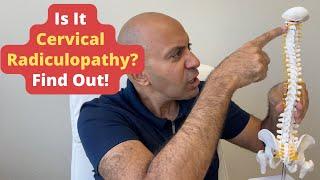 Diagnosing Cervical Radiculopathy Made Easy: 3 Key Signs You Shouldn't Ignore!