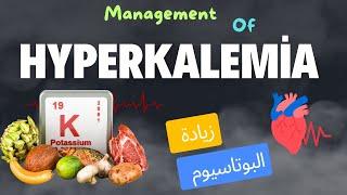 علاج زيادة البوتاسيوم (Hyperkalemia)