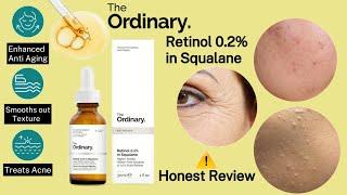 The Ordinary Retinol 0.2 in Squalane review ️|Best retinol serum | retinol for beginners