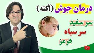 عالی ترین روش درمان انواع جوش به صورت ریشه ای و پاکسازی و جوانسازی پوست به سبک دکتر جاوید