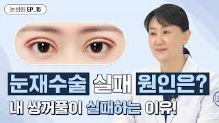 환자들이 눈 재수술을 하는 원인은 과연 뭘까?!