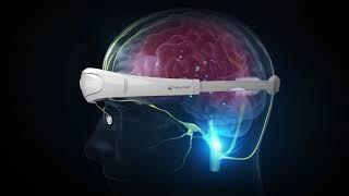 Relivion Brain Neuromodulation - How it works