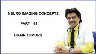 NEURO IMAGING CONCEPTS PART 41,BRAIN TUMORS