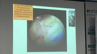 Is Endoscopic Spine Surgery the Future? Dr Byapak Paudel