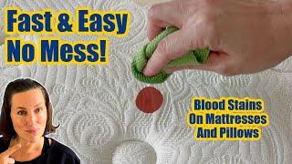 How To Remove Blood Stains From Mattresses And Pillows With Hydrogen Peroxide (Period Stains Too)