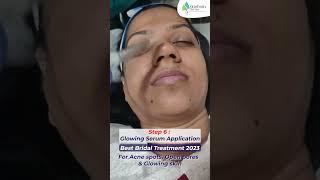 Best Bridal Treatment 2023 | Best Pre Bridal Skincare Treatment