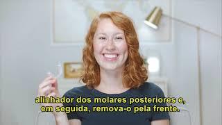 Como iniciar seu tratamento com Invisalign