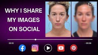 The Truth About Before & After Images on Social Media | Mabrie Facial Institute in San Francisco, CA