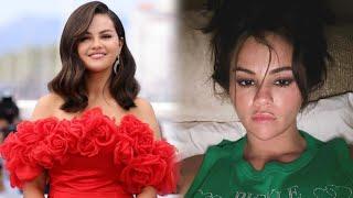 Selena Gomez | Selena Gomez Claps Back at Plastic Surgery Speculation | Exclusive